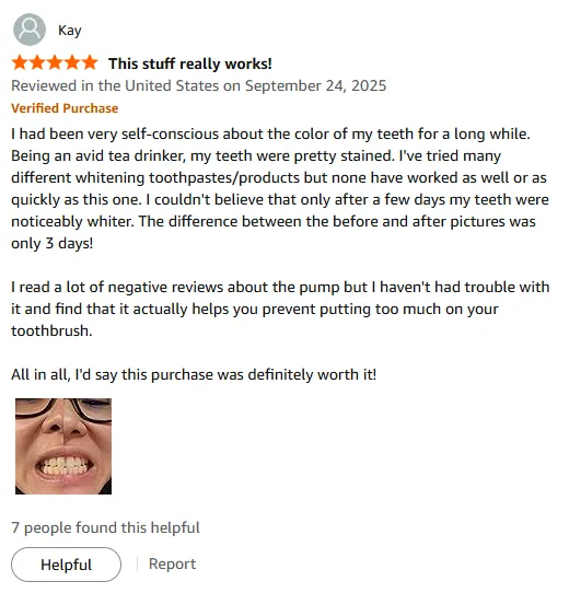 My Teeth Got Whiter in Days – Top Whitening Toothpaste